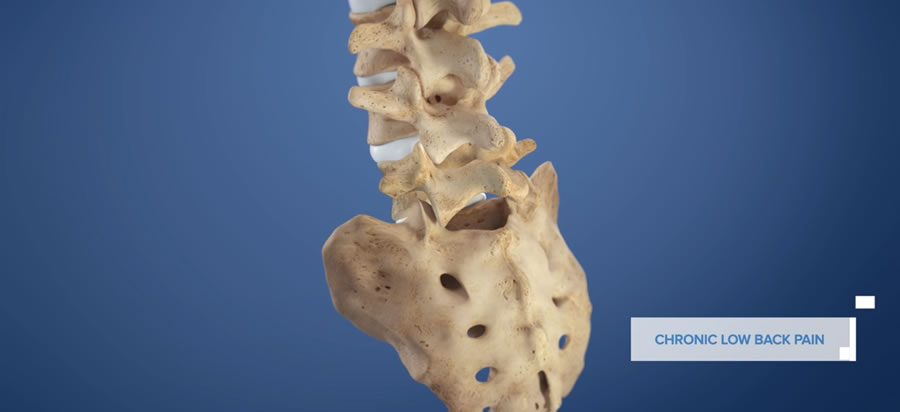 Acupuncture Services are back at Virginia iSpine Physicians!